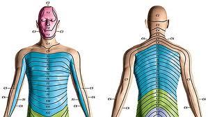 Dermatone in Postherpetic Neuralgia Pain Treated With Interferential Therapy